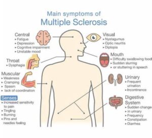 #MultipleSclerosis #MSResearch #CognitiveHealth #Fampridine #MemoryBoost #Neurology #MSAwareness #BrainHealth